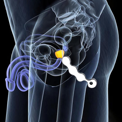 Stainless Steel Prostate Massager with Pulling String - image 1