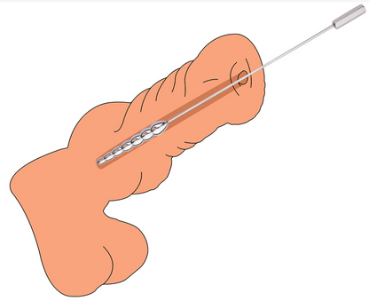 Beaded Stainless Steel Urethral Sound - image 6