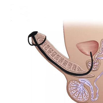 Fixable Silicone Urethral Sound - image 0