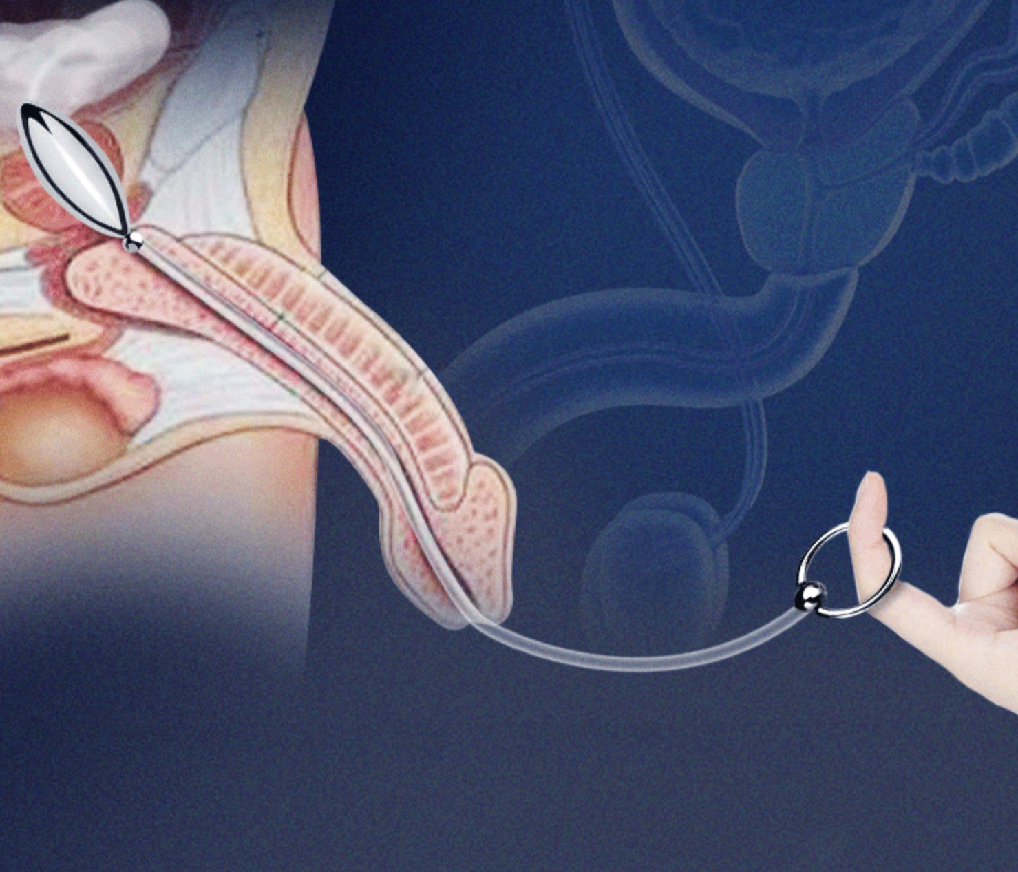 Urethral Sound Bead with String - image 1