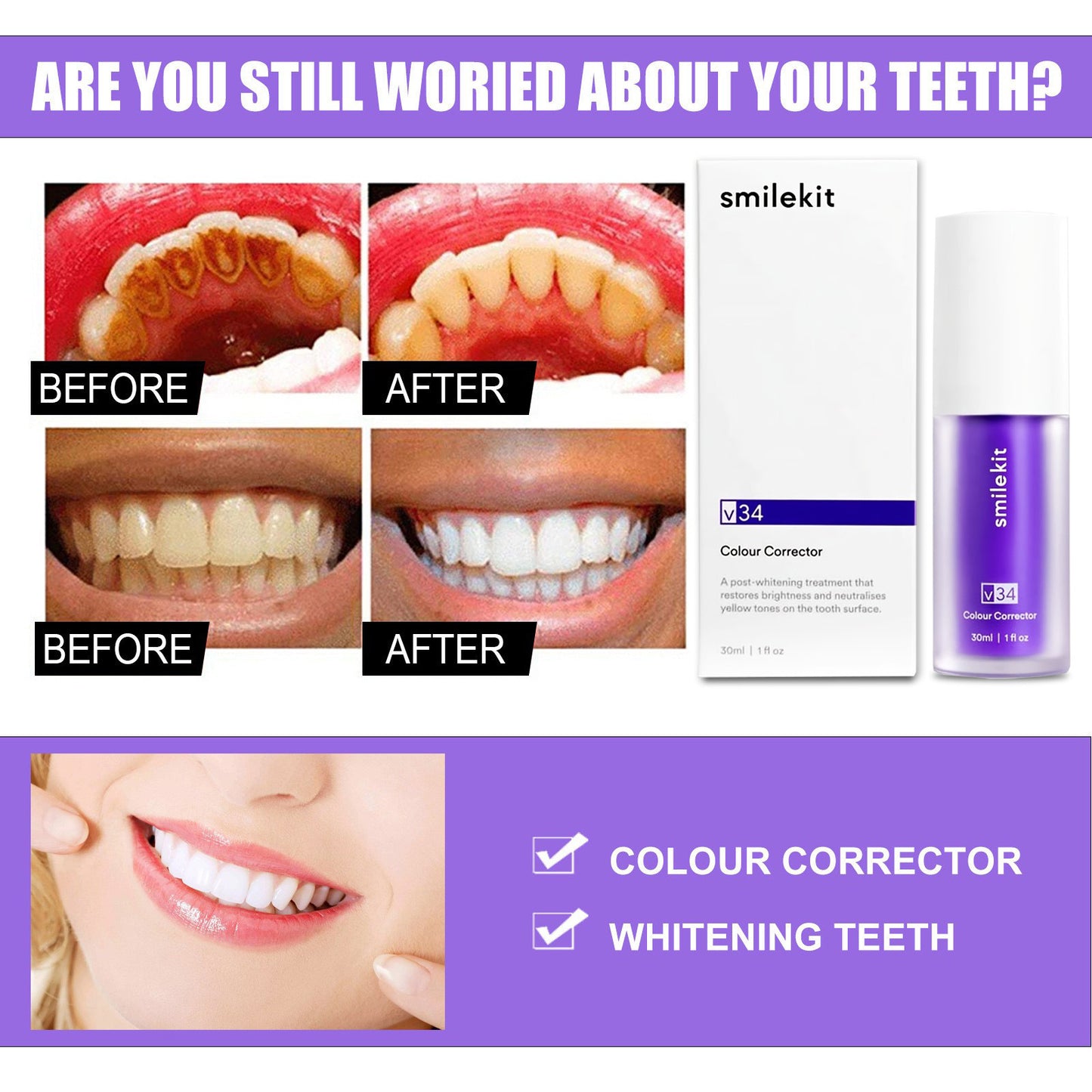 Teeth Whitening Serum V34