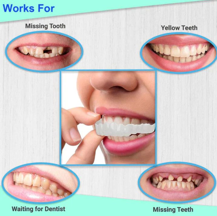 Smile Veneers Instant Snap-on Teeth Veneer ( Upper & Lower Set )